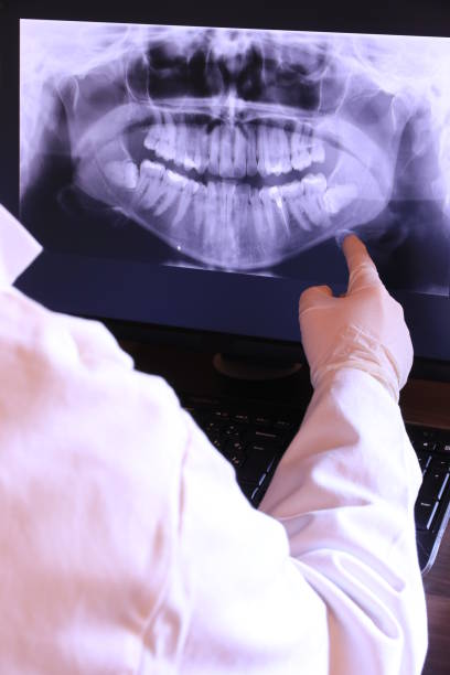 Best Emergency Gum Treatment in Picnic Point, WA